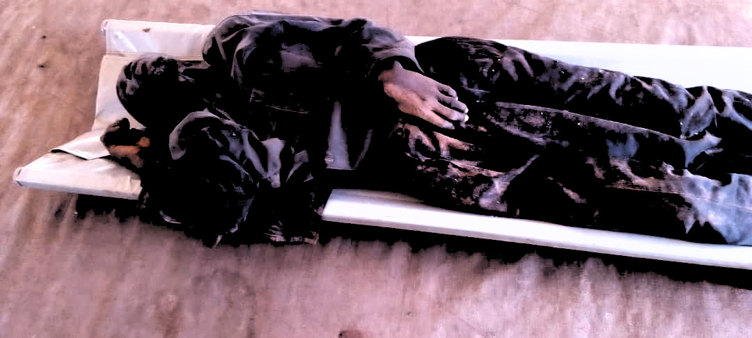 RDC : un corps sans vie retrouvé à l’entrée du centre de santé de Kamako dans le Kasaï